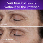 Olay Retinol Night Cream for Women, MAX, Anti-Aging Face Mousturizer, Fragrance-Free, Non Greasy - Anti-Wrinkle, Smooth Fine Lines, Hydrating Skin Care - Triple Collagen Cream, Niacinamide, 1.7oz