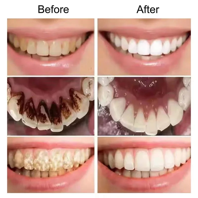 V34 Purple Teeth Whitening Toothpaste Remove Plaque Stains Cleaning Oral Hygiene Dental Bleach
