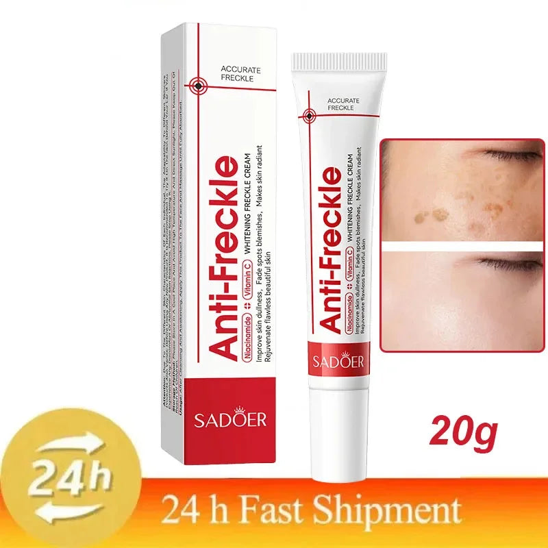 Whitening Freckle Cream Remove Dark Spots Anti Freckle Face Creams Niacinamide Fade Pigmentation