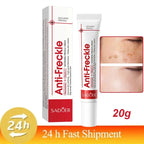 Whitening Freckle Cream Remove Dark Spots Anti Freckle Face Creams Niacinamide Fade Pigmentation
