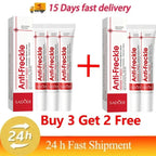 Whitening Freckle Cream Remove Dark Spots Anti Freckle Face Creams Niacinamide Fade Pigmentation