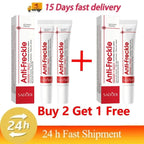 Whitening Freckle Cream Remove Dark Spots Anti Freckle Face Creams Niacinamide Fade Pigmentation