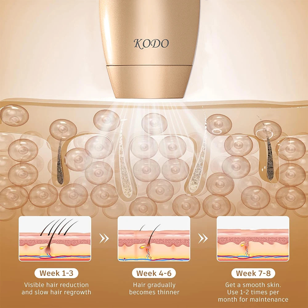 KODO 2026 High-end customization ice Laser Hair removal Laser Epilator Permanent