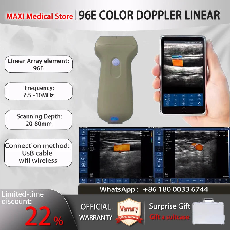 Wireless Ultrasound Probe scanner machine Portable WIFI ultrasound scanner Machine support