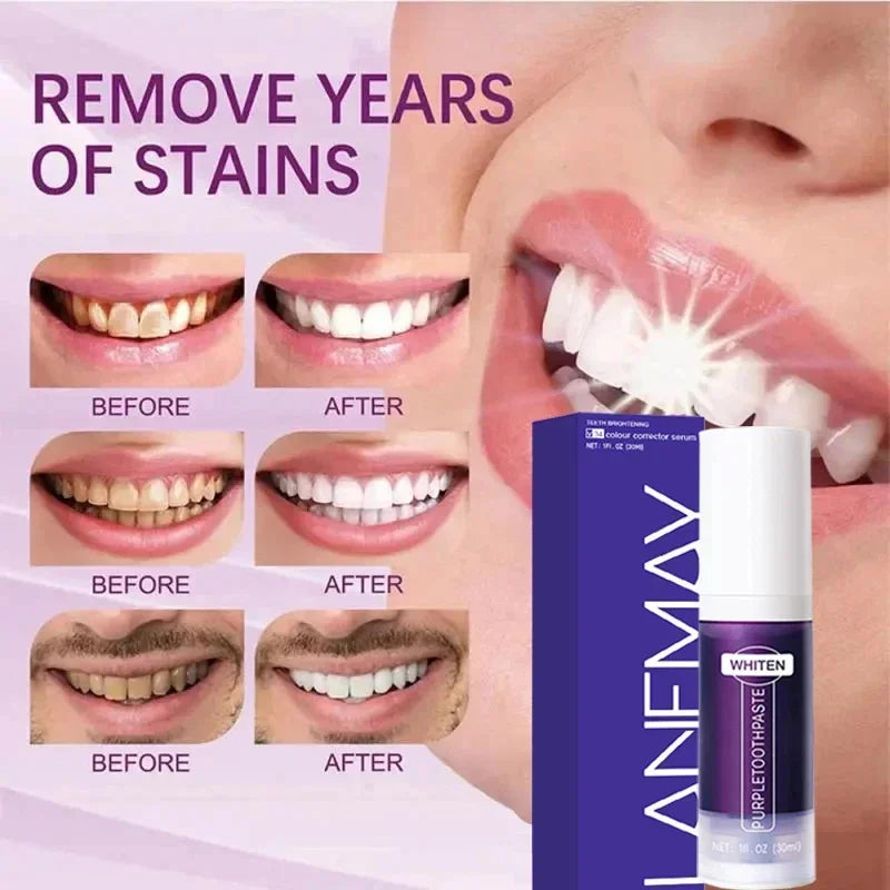 V34 Purple Teeth Whitening Toothpaste Remove Plaque Stains Cleaning Oral Hygiene Dental Bleach
