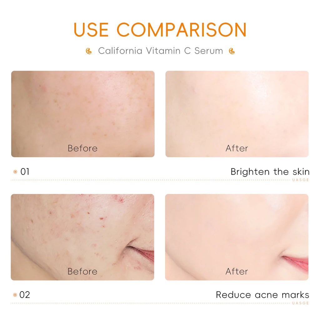 7pcs LAIKOU Vitamin C Deep Moisturizing Face Serum Nourishing Rejuvenation Skin Serum Shrink Pore