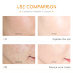 7pcs LAIKOU Vitamin C Deep Moisturizing Face Serum Nourishing Rejuvenation Skin Serum Shrink Pore