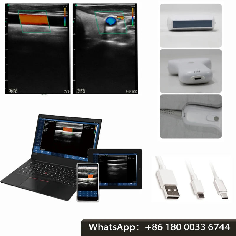 Wireless Ultrasound Probe scanner machine Portable WIFI ultrasound scanner Machine support
