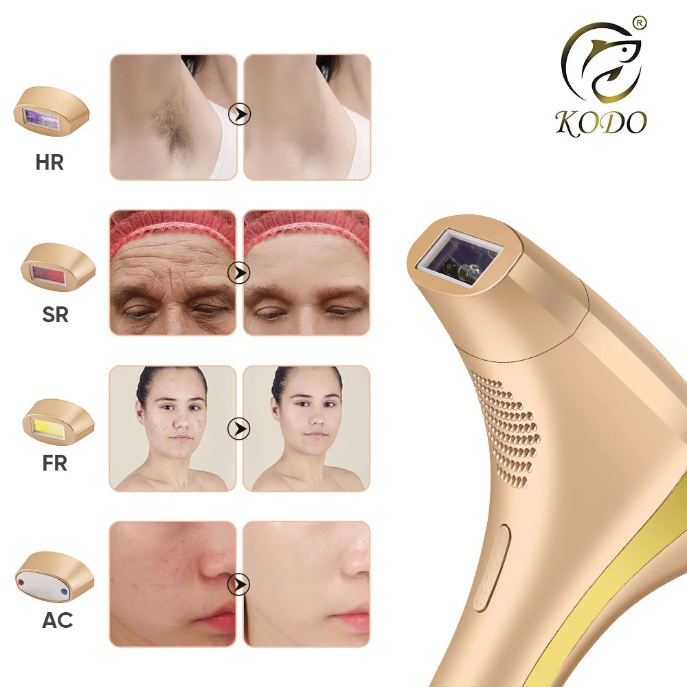 KODO 2026 High-end customization ice Laser Hair removal Laser Epilator Permanent